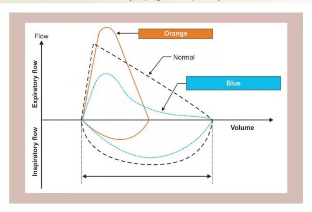 images/MNJ-P-OSCE 06. Audiometry, capnogram, spirometry_page_8_Picture_2.jpeg