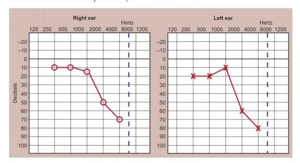 images/MNJ-P-OSCE 06. Audiometry, capnogram, spirometry_page_9_Figure_5.jpeg