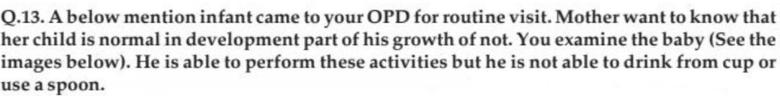 images/MNJ-P-OSCE 08. Growth monitoring_page_21_Picture_2.jpeg
