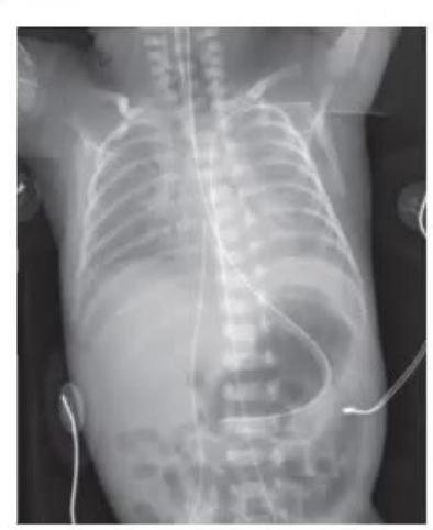 images/MNJ-P-OSCE 09. Intensive care_page_5_Picture_28.jpeg