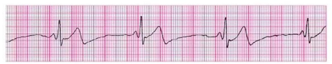 images/MNJ-P-OSCE 10. Advanced Life support_page_12_Figure_7.jpeg