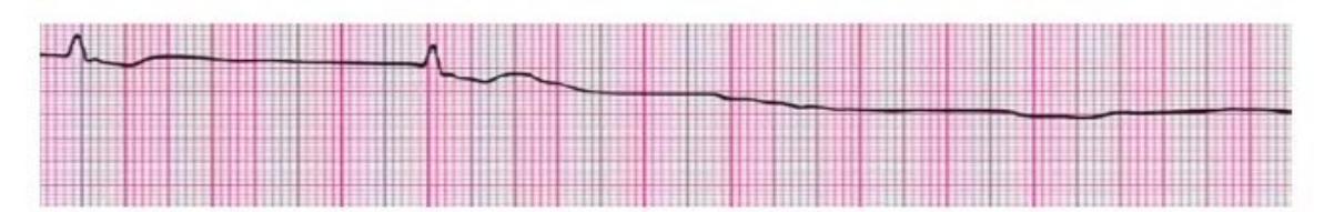 images/MNJ-P-OSCE 10. Advanced Life support_page_13_Figure_2.jpeg