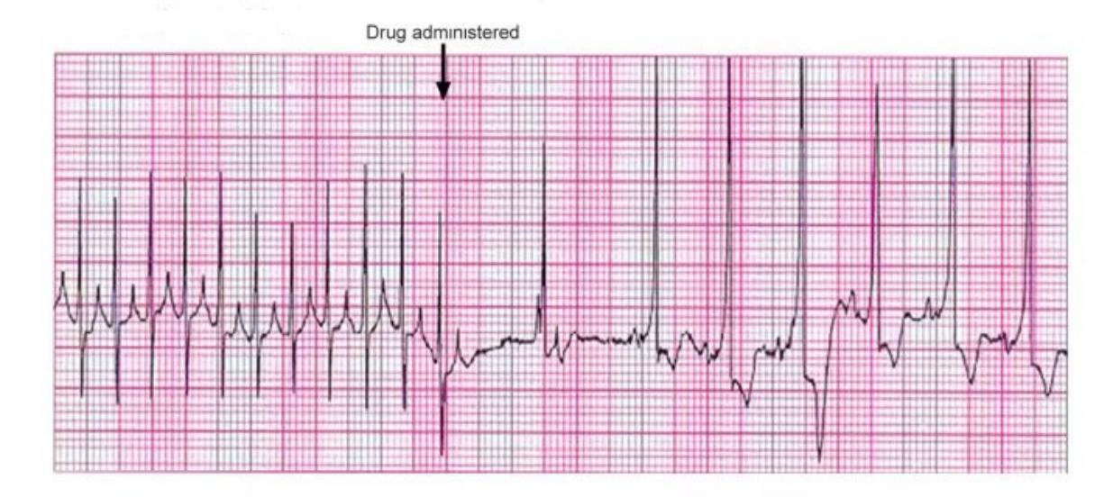 images/MNJ-P-OSCE 10. Advanced Life support_page_14_Figure_8.jpeg