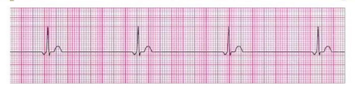 images/MNJ-P-OSCE 10. Advanced Life support_page_15_Figure_2.jpeg