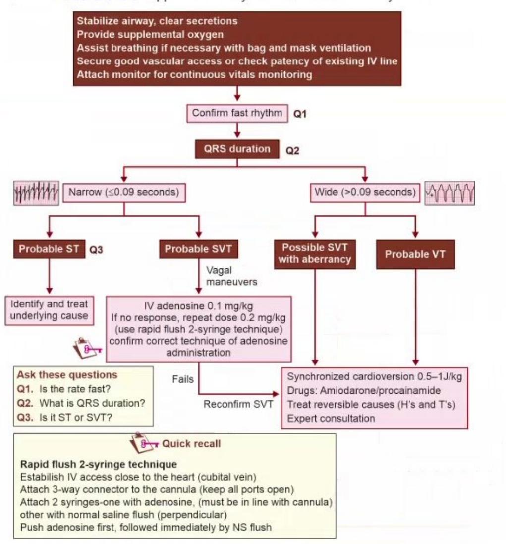 images/MNJ-P-OSCE 10. Advanced Life support_page_9_Figure_3.jpeg