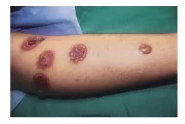 images/MNJ-P-OSCE 14. Dermatology_page_12_Picture_12.jpeg