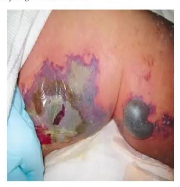 images/MNJ-P-OSCE 14. Dermatology_page_12_Picture_7.jpeg