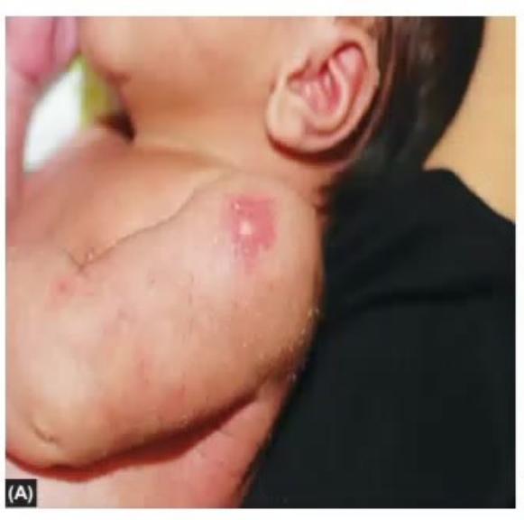 images/MNJ-P-OSCE 14. Dermatology_page_6_Picture_1.jpeg