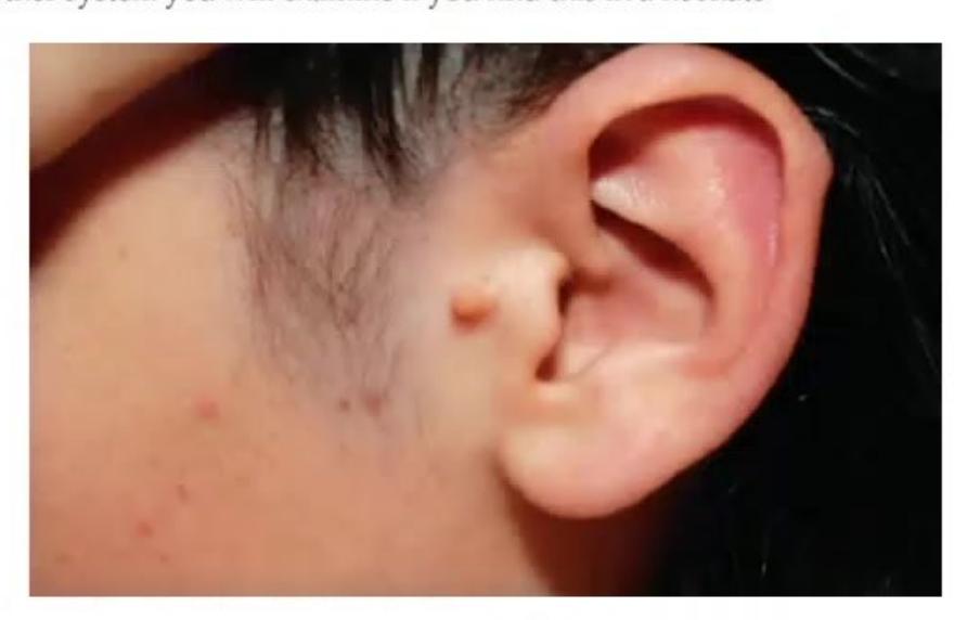 images/MNJ-P-OSCE 14. Dermatology_page_6_Picture_9.jpeg