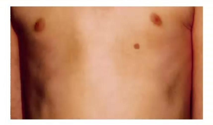 images/MNJ-P-OSCE 14. Dermatology_page_7_Picture_1.jpeg