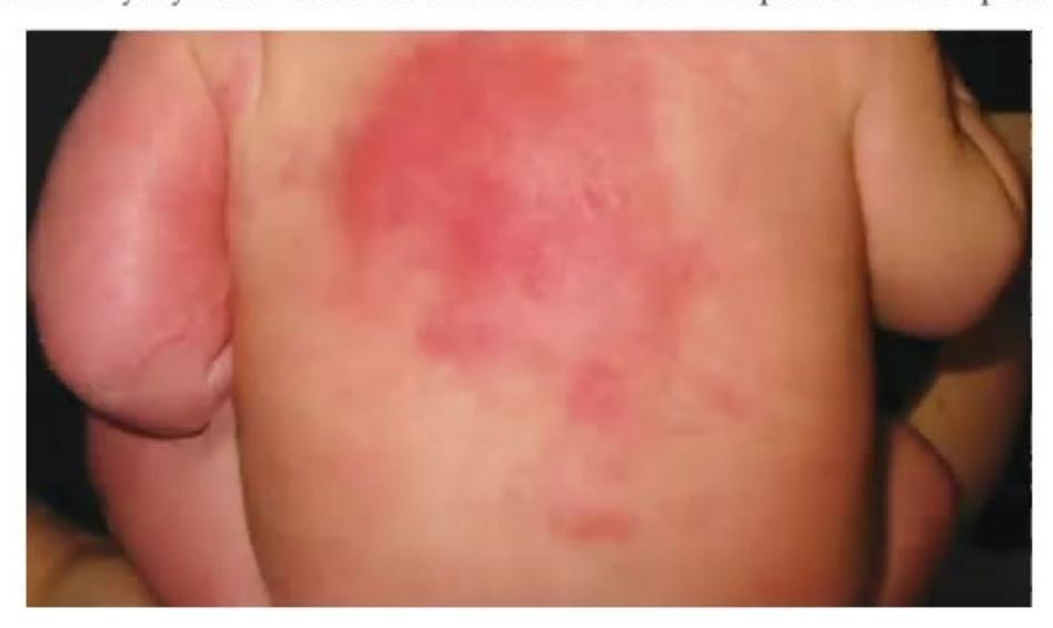 images/MNJ-P-OSCE 14. Dermatology_page_7_Picture_9.jpeg