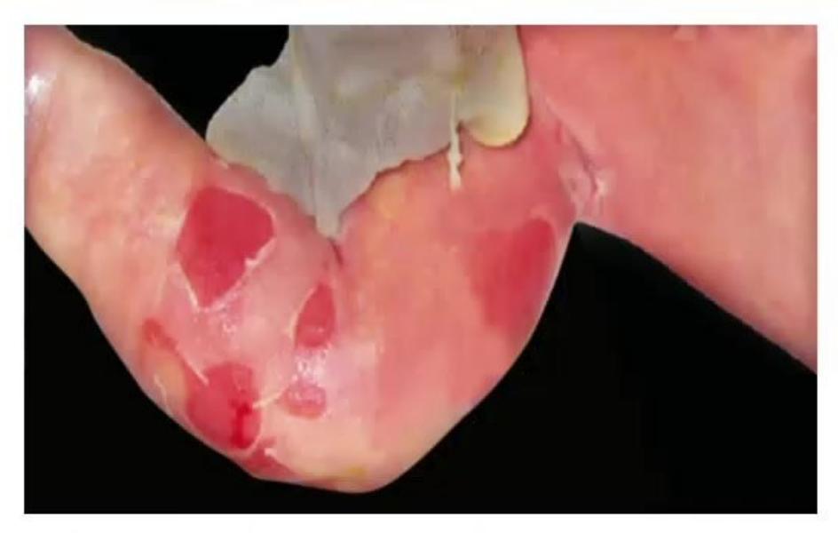 images/MNJ-P-OSCE 14. Dermatology_page_9_Picture_1.jpeg