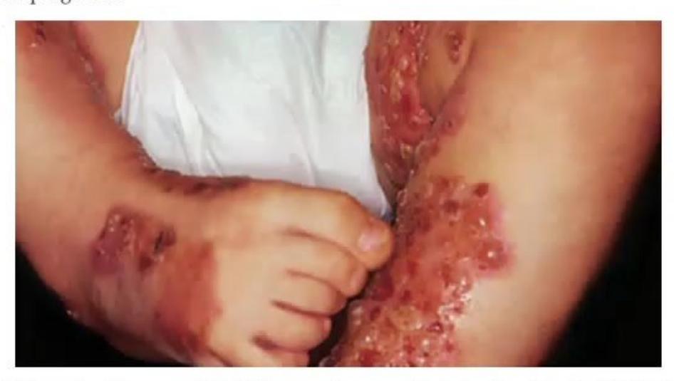 images/MNJ-P-OSCE 14. Dermatology_page_9_Picture_7.jpeg