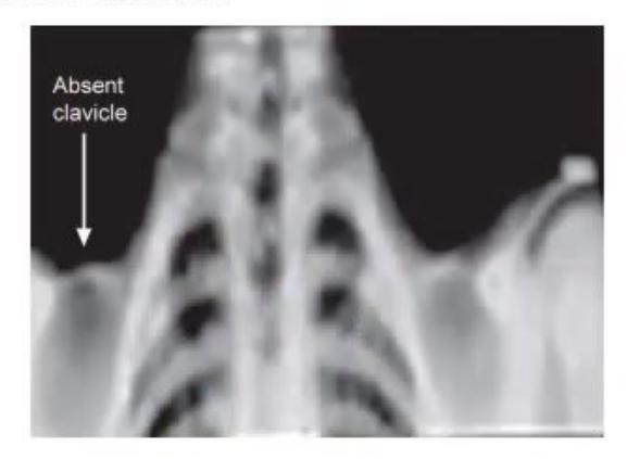 images/MNJ-P-OSCE 16. Genetic disorder_page_12_Picture_14.jpeg