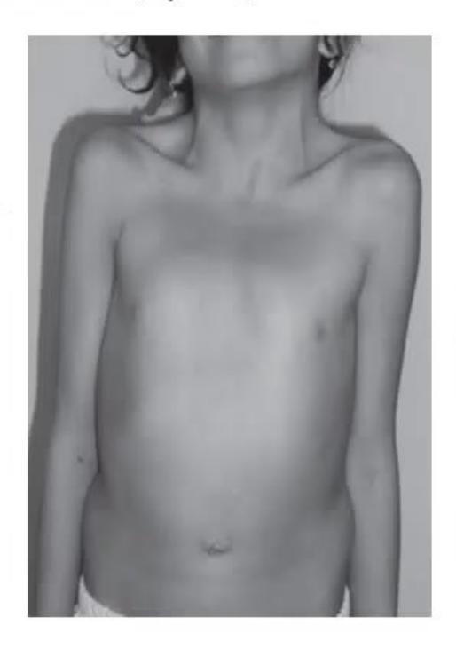 images/MNJ-P-OSCE 16. Genetic disorder_page_13_Picture_13.jpeg