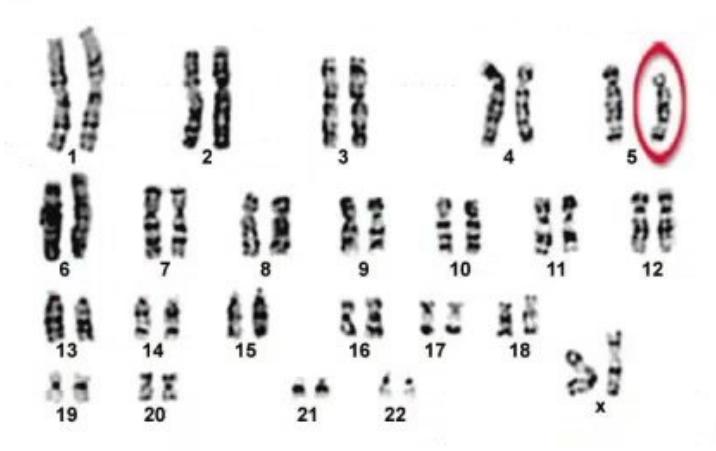 images/MNJ-P-OSCE 16. Genetic disorder_page_13_Picture_8.jpeg