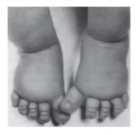 images/MNJ-P-OSCE 16. Genetic disorder_page_6_Picture_19.jpeg