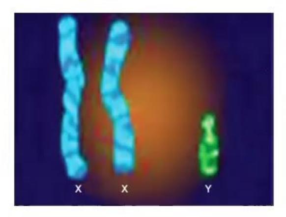 images/MNJ-P-OSCE 16. Genetic disorder_page_7_Picture_9.jpeg