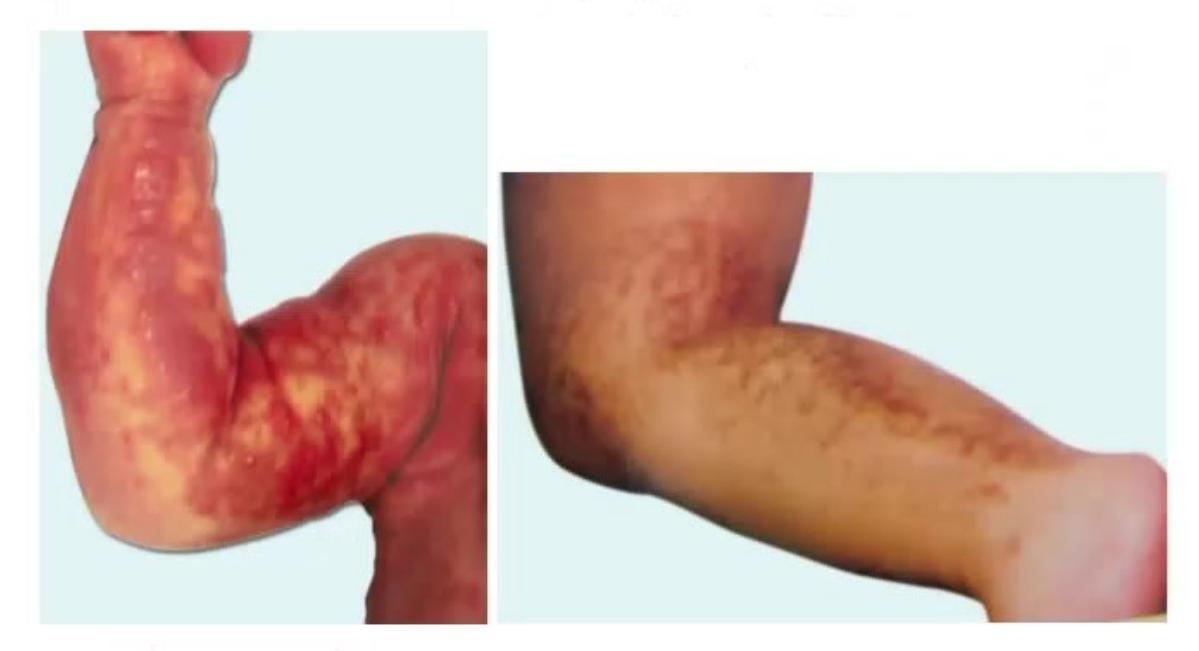 images/MNJ-P-OSCE 16. Genetic disorder_page_8_Picture_7.jpeg