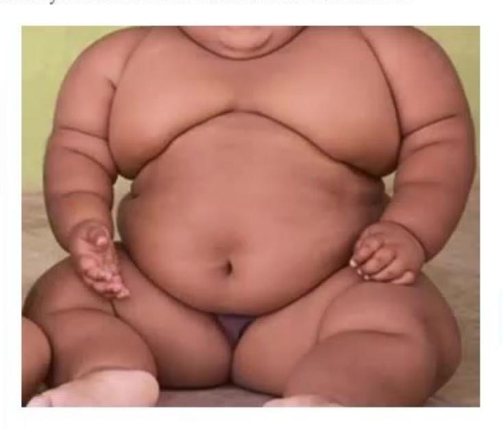 images/MNJ-P-OSCE 16. Genetic disorder_page_9_Picture_14.jpeg