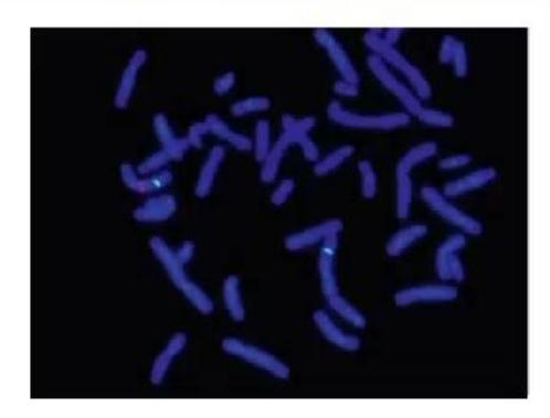 images/MNJ-P-OSCE 16. Genetic disorder_page_9_Picture_2.jpeg