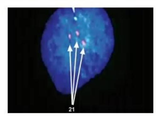 images/MNJ-P-OSCE 16. Genetic disorder_page_9_Picture_3.jpeg