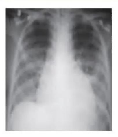 images/MNJ-P-OSCE 18. Immunodeficiency_page_1_Picture_2.jpeg