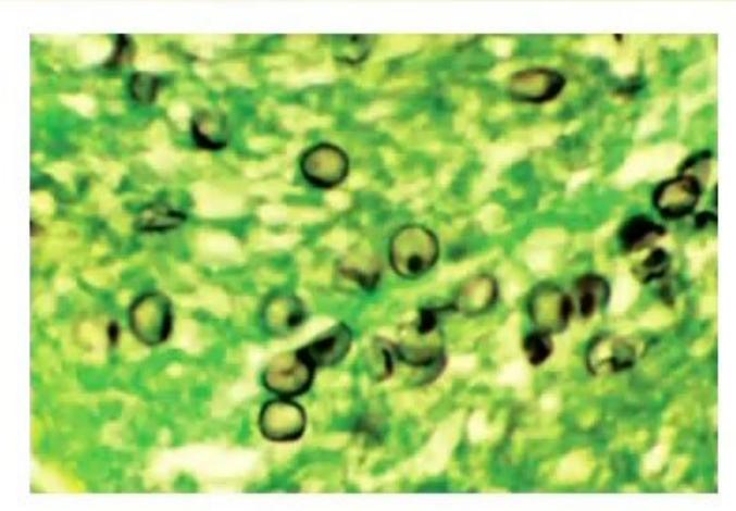 images/MNJ-P-OSCE 18. Immunodeficiency_page_1_Picture_3.jpeg