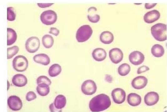 images/MNJ-P-OSCE 18. Immunodeficiency_page_2_Picture_3.jpeg