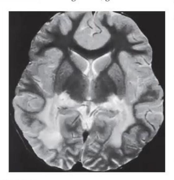 images/MNJ-P-OSCE 19. Metabolic disorder_page_12_Picture_9.jpeg