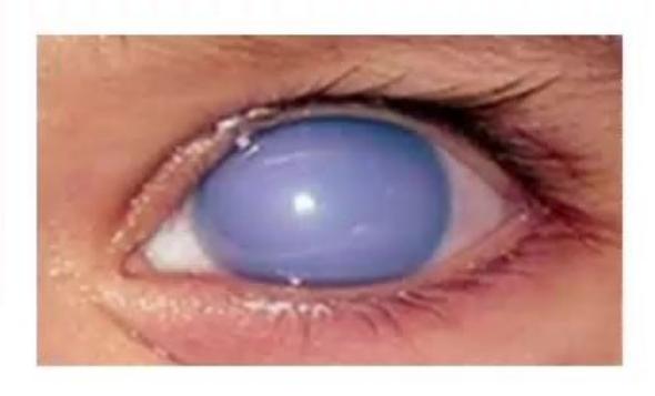 images/MNJ-P-OSCE 19. Metabolic disorder_page_7_Picture_18.jpeg
