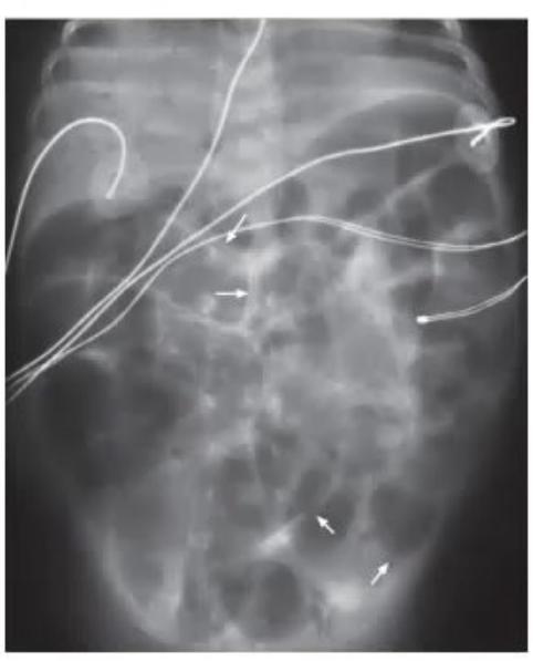 images/MNJ-P-OSCE 21. Neonatology_page_0_Picture_7.jpeg