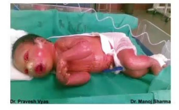 images/MNJ-P-OSCE 21. Neonatology_page_1_Picture_11.jpeg