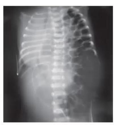 images/MNJ-P-OSCE 21. Neonatology_page_1_Picture_2.jpeg