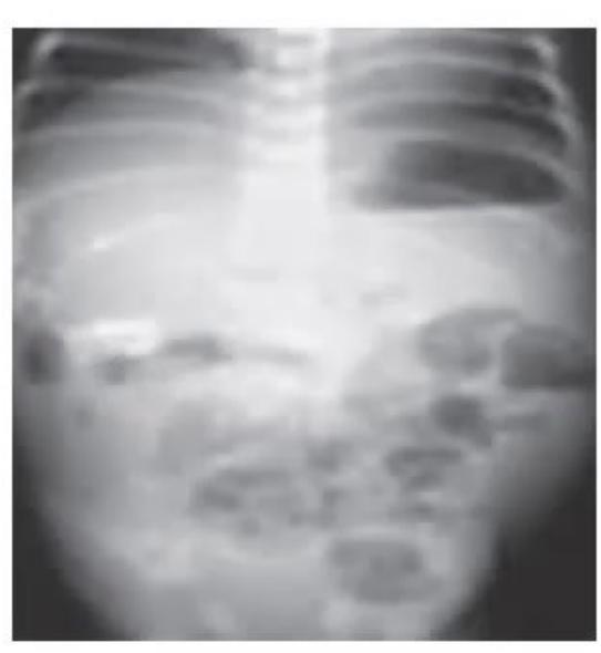 images/MNJ-P-OSCE 21. Neonatology_page_3_Picture_12.jpeg