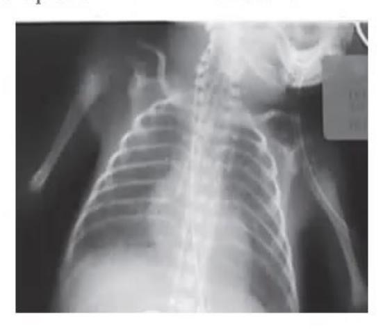 images/MNJ-P-OSCE 21. Neonatology_page_5_Picture_12.jpeg