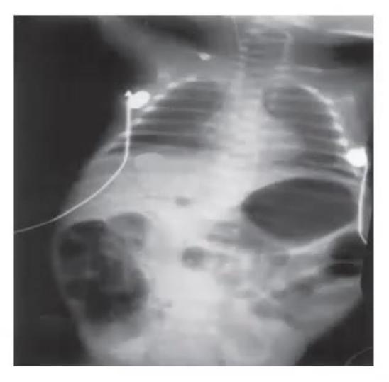 images/MNJ-P-OSCE 21. Neonatology_page_5_Picture_8.jpeg