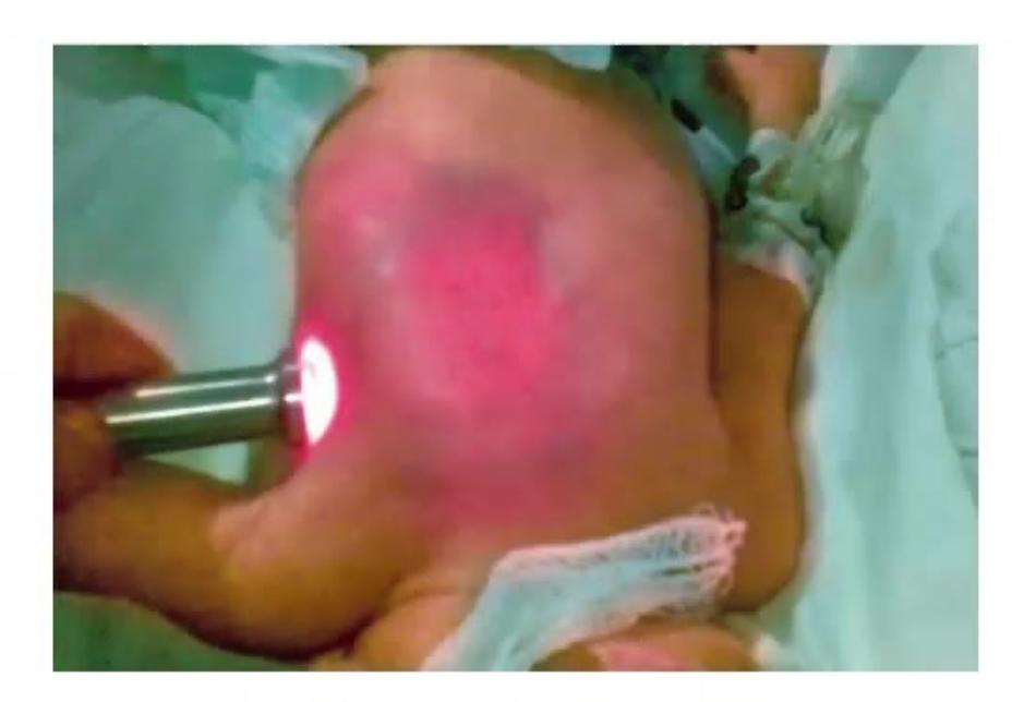images/MNJ-P-OSCE 21. Neonatology_page_6_Picture_5.jpeg