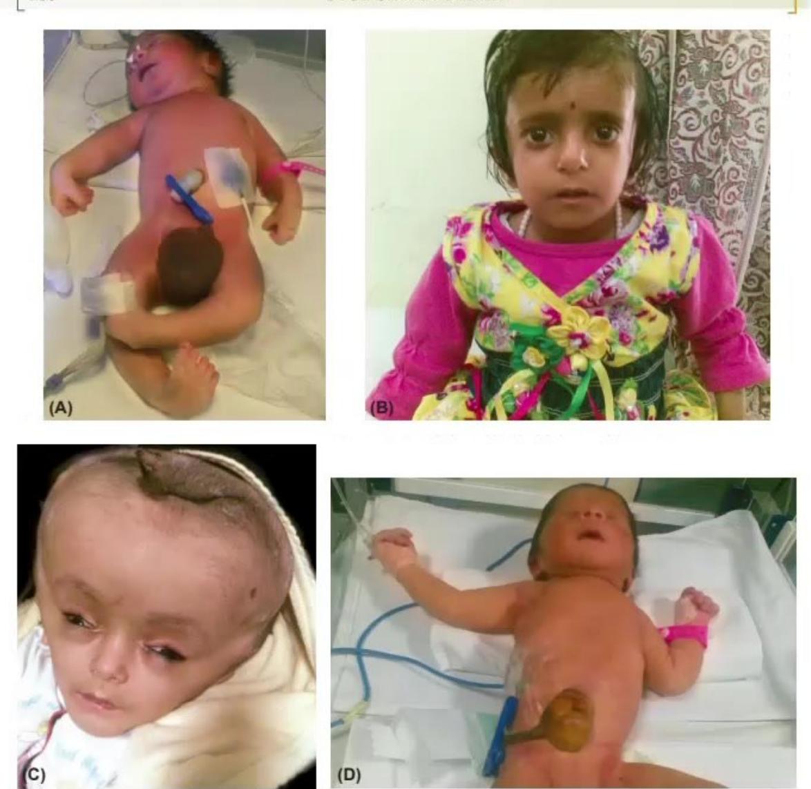 images/MNJ-P-OSCE 21. Neonatology_page_7_Picture_2.jpeg