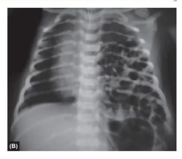 images/MNJ-P-OSCE 21. Neonatology_page_8_Picture_2.jpeg
