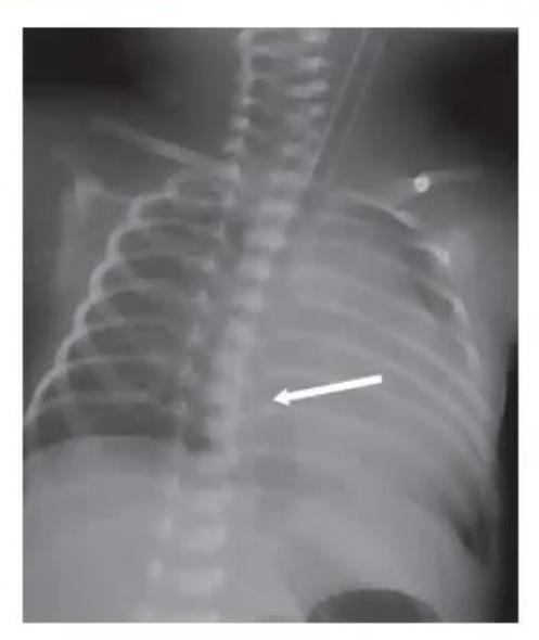 images/MNJ-P-OSCE 21. Neonatology_page_9_Picture_18.jpeg