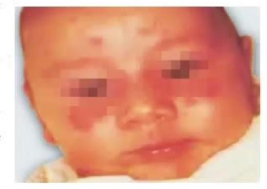 images/MNJ-P-OSCE 22. Connective tissue disorder_page_0_Picture_22.jpeg