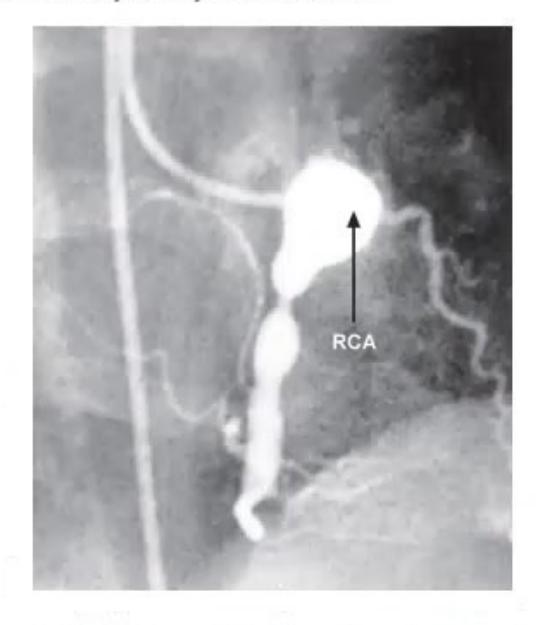 images/MNJ-P-OSCE 22. Connective tissue disorder_page_1_Picture_16.jpeg