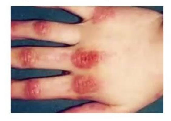 images/MNJ-P-OSCE 22. Connective tissue disorder_page_2_Picture_23.jpeg