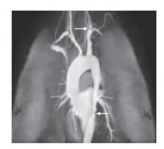 images/MNJ-P-OSCE 22. Connective tissue disorder_page_3_Picture_10.jpeg