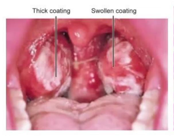 images/MNJ-P-OSCE 23. Infectious disease_page_10_Picture_17.jpeg