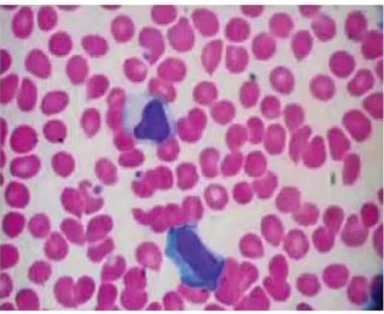 images/MNJ-P-OSCE 23. Infectious disease_page_10_Picture_18.jpeg