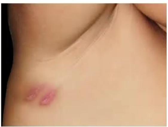 images/MNJ-P-OSCE 23. Infectious disease_page_10_Picture_9.jpeg