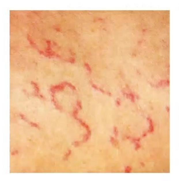 images/MNJ-P-OSCE 23. Infectious disease_page_11_Picture_11.jpeg