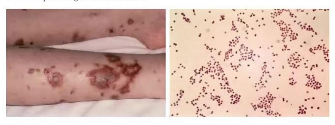 images/MNJ-P-OSCE 23. Infectious disease_page_11_Picture_7.jpeg